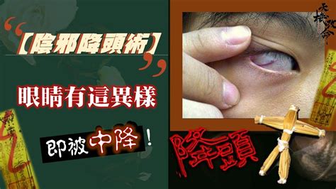 陰煞被下符眼睛|被下降頭眼睛？教你如何化解！